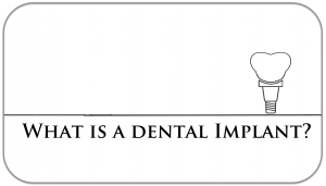 dental implants jupiter fl