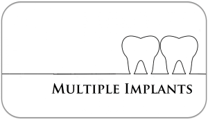 Multiple implants Jupiter Fl