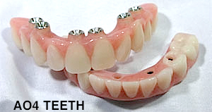 Omar Abdo AO4 Teeth
